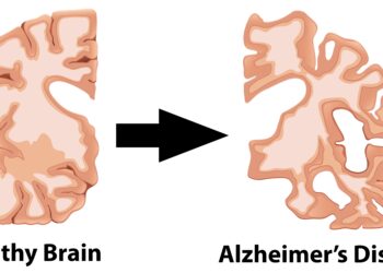 Alzheimer’ Anatomy
